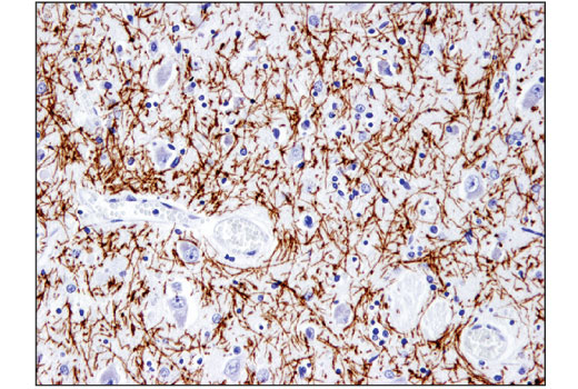 Immunohistochemistry Image 1: Myelin Basic Protein (D8X4Q) XP<sup>®</sup> Rabbit mAb