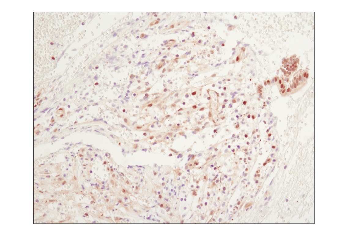 undefined Image 10: PhosphoPlus<sup>®</sup> NF-κB p65/RelA (Ser536) Antibody Duet