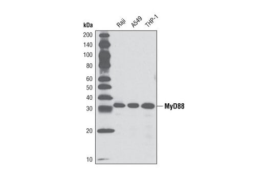 Western Blotting Image 1: MyD88 (D80F5) Rabbit mAb