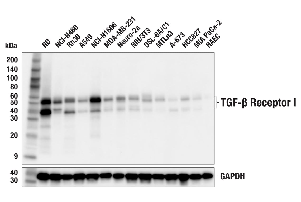 Western Blotting Image 1: TGF-β Receptor I (F6L3I) Rabbit mAb