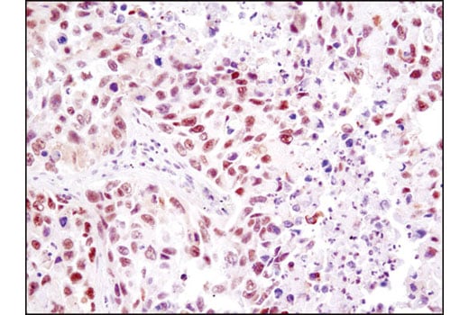 undefined Image 30: Mouse Reactive Pyroptosis Antibody Sampler Kit