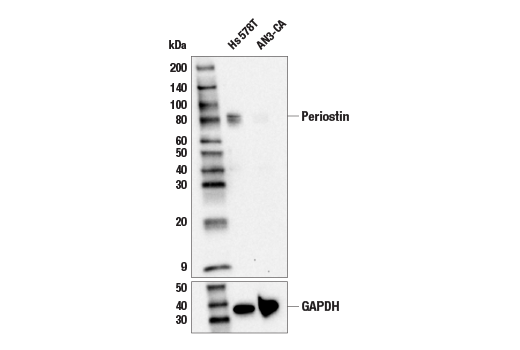 undefined Image 2: Extracellular Matrix Dynamics Antibody Sampler Kit