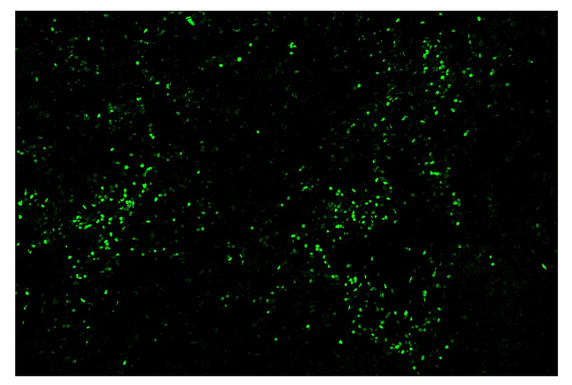 Immunohistochemistry Image 2: TCF1/TCF7 (C63D9) & CO-0006-488 SignalStar<sup>™</sup> Oligo-Antibody Pair