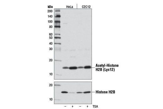 Western Blotting Image 1: Acetyl-Histone H2B (Lys12) (D7H4) Rabbit mAb