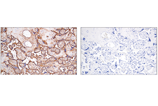 Immunohistochemistry Image 6: CD141/Thrombomodulin (E7Y9P) XP<sup>®</sup> Rabbit mAb