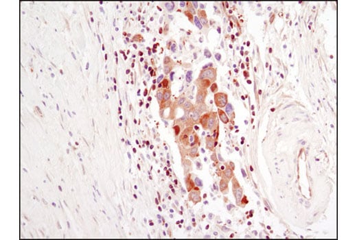 Immunohistochemistry Image 1: PLCγ1 (D9H10) XP<sup>®</sup> Rabbit mAb (BSA and Azide Free)