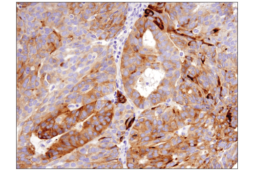 Immunohistochemistry Image 5: Synaptophysin (D8F6H) XP<sup>®</sup> Rabbit mAb (BSA and Azide Free)