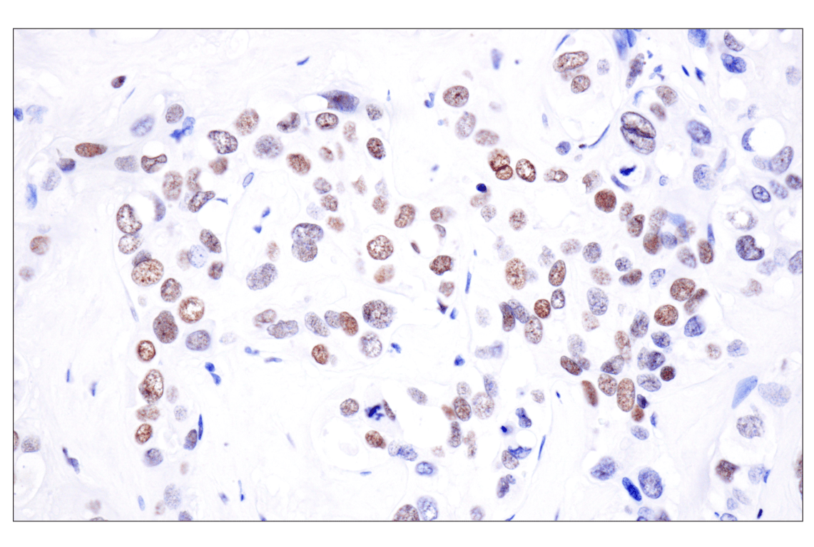 Immunohistochemistry Image 3: Acetyl-Histone H4 (Lys16) (E2B8W) Rabbit mAb