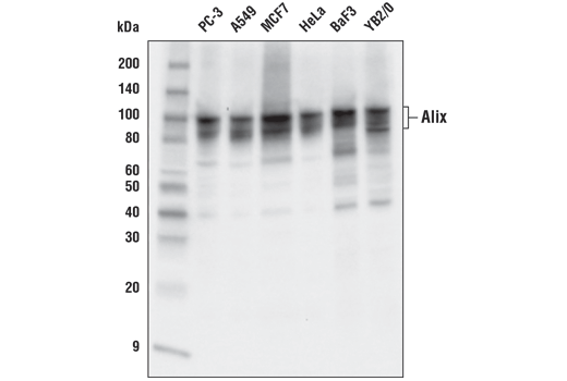 Western Blotting Image 2: Alix (E6P9B) Rabbit mAb