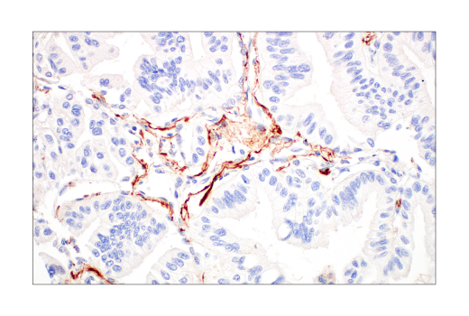 undefined Image 42: Late-Onset Alzheimer's Disease Risk Gene Antibody Sampler Kit