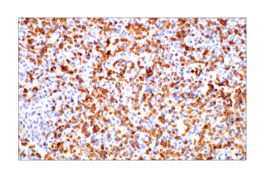 Immunohistochemistry Image 10: Glut1 (E4S6I) Rabbit mAb