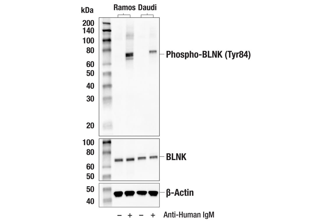 Western Blotting Image 1: Phospho-BLNK (Tyr84) (E6A9C) Rabbit mAb