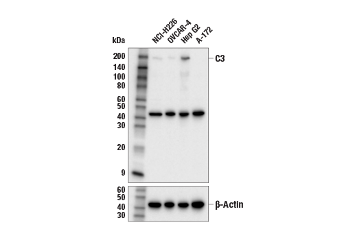Western Blotting Image 1: Complement C3 (E2O5U) Rabbit mAb