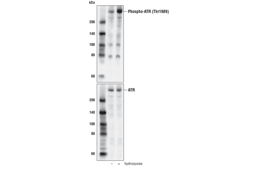 undefined Image 2: PhosphoPlus<sup>®</sup> ATR (Thr1989) Antibody Duet