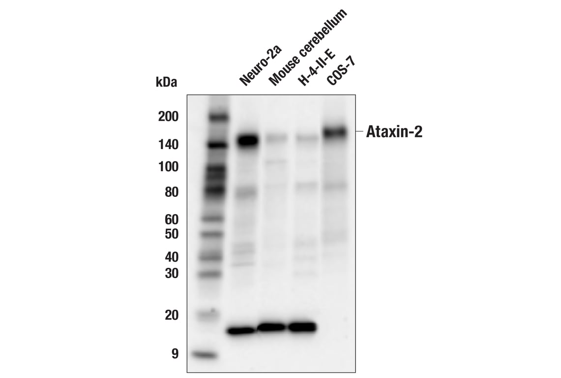 Western Blotting Image 2: Ataxin-2 (E3B3Z) Rabbit mAb