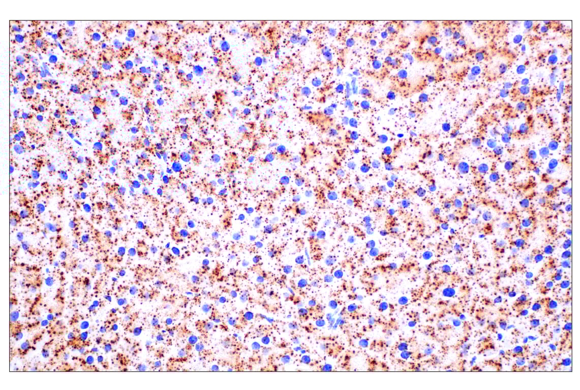Immunohistochemistry Image 8: Cathepsin D (E5V4H) Rabbit mAb