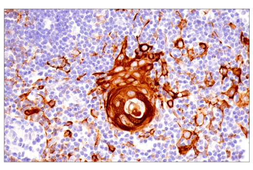 Immunohistochemistry Image 4: Pan-Keratin (5D3/LP34) Mouse mAb