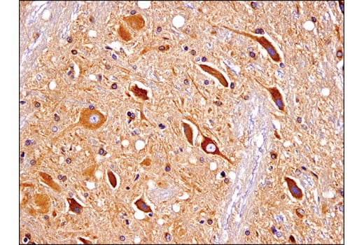 Immunohistochemistry Image 3: Huntingtin (D7F7) XP<sup>®</sup> Rabbit mAb