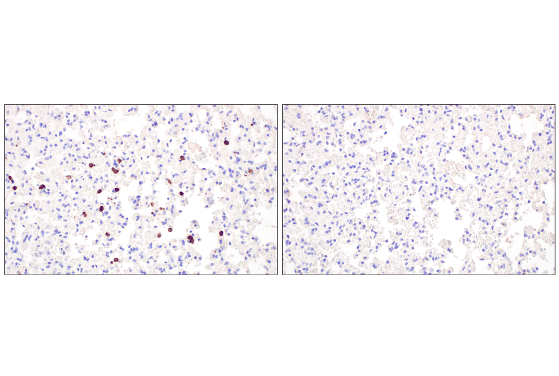 Immunohistochemistry Image 5: CD20 (E3N7O) XP<sup>®</sup> Rabbit mAb