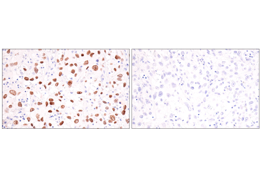 Immunohistochemistry Image 3: p40 (BC28) Mouse mAb