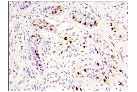 Immunohistochemistry Image 3: PAF15 (D8E2Y) XP<sup>®</sup> Rabbit mAb