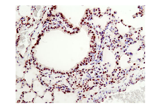 undefined Image 18: Mouse Reactive Pyroptosis Antibody Sampler Kit