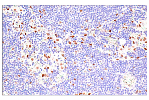 Immunohistochemistry Image 4: Bcl-3 (E4D4K) Rabbit mAb