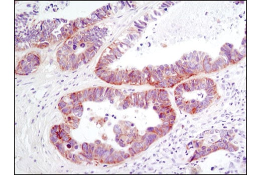 Immunohistochemistry Image 1: DDR1 (D1G6) XP<sup>®</sup> Rabbit mAb