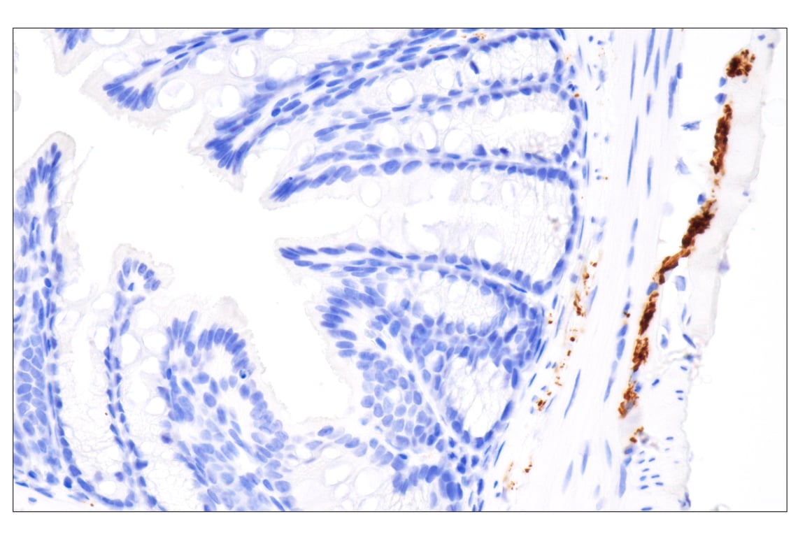 Immunohistochemistry Image 2: Tyrosine Hydroxylase (E2L6M) Rabbit mAb (BSA and Azide Free)