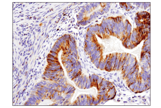 undefined Image 22: Pro-Apoptosis Bcl-2 Family Antibody Sampler Kit II