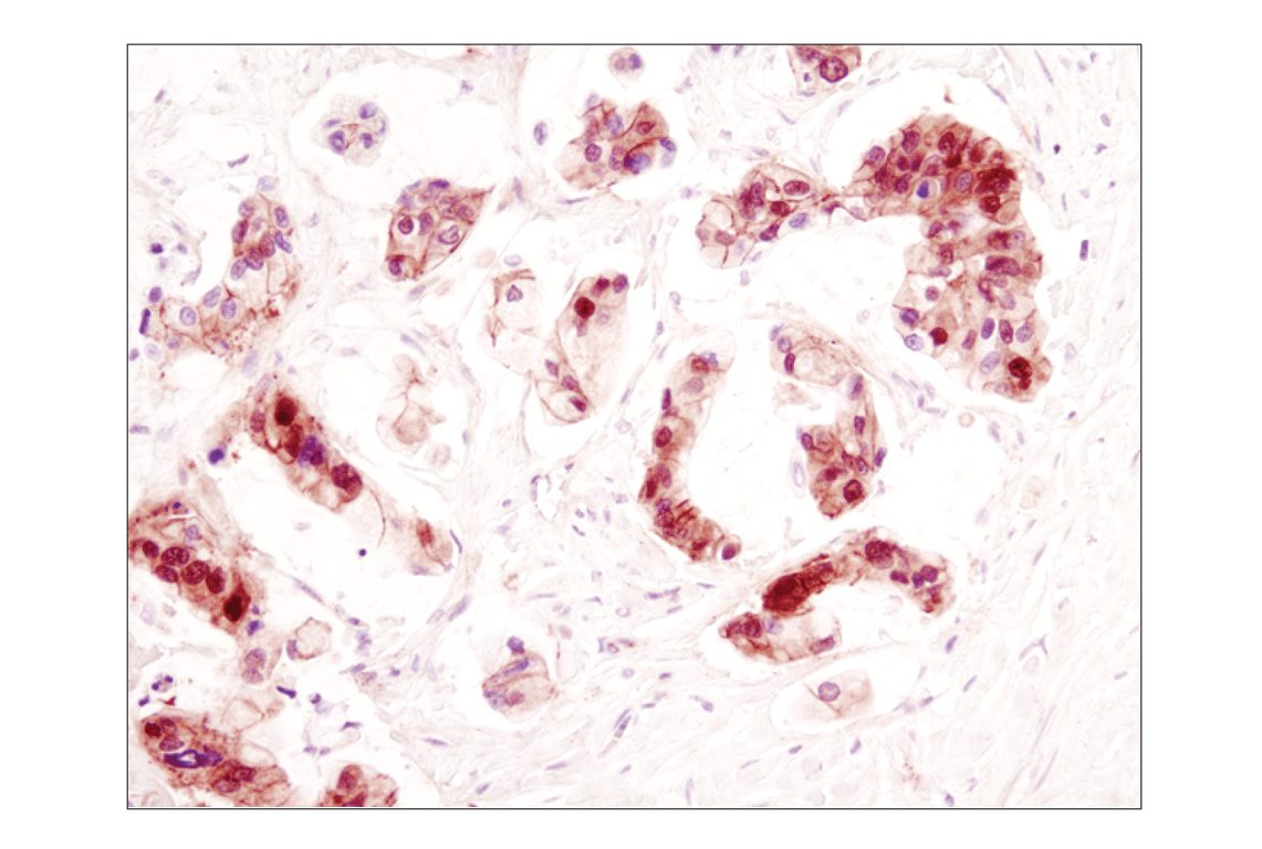undefined Image 40: Cadherin-Catenin Antibody Sampler Kit