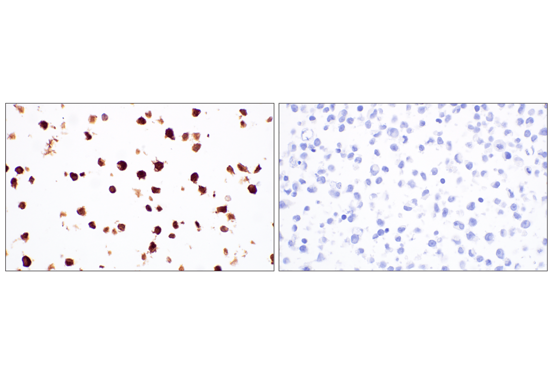 Immunohistochemistry Image 10: Catalase (D4P7B) XP<sup>®</sup> Rabbit mAb