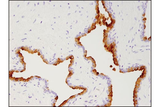Immunohistochemistry Image 1: Prostate Specific Membrane Antigen (D7I8E) XP<sup>®</sup> Rabbit mAb (BSA and Azide Free)