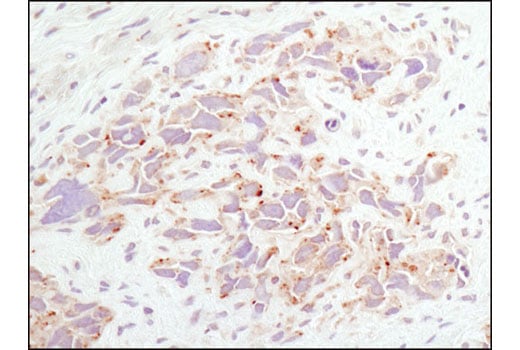 undefined Image 11: Rag and LAMTOR Antibody Sampler Kit
