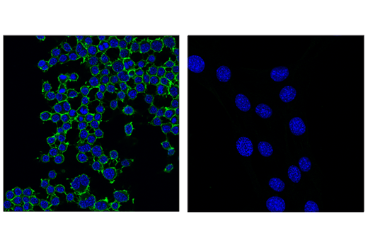 Immunofluorescence Image 1: CD45 (D3F8Q) Rabbit mAb (Alexa Fluor<sup>®</sup> 488 Conjugate)