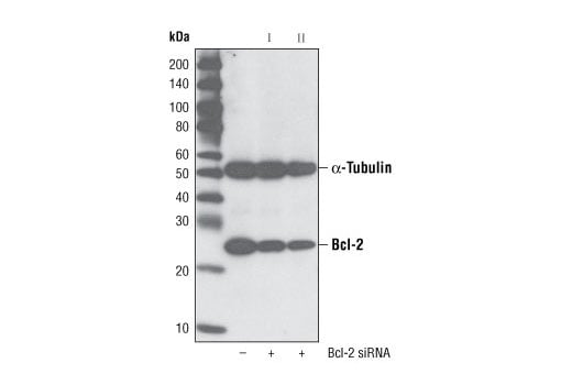 undefined Image 1: SignalSilence<sup>®</sup> Bcl-2 siRNA II