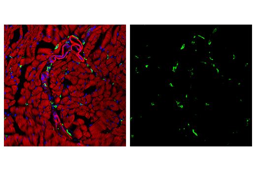 undefined Image 80: Mouse Reactive M1 vs M2 Macrophage IHC Antibody Sampler Kit