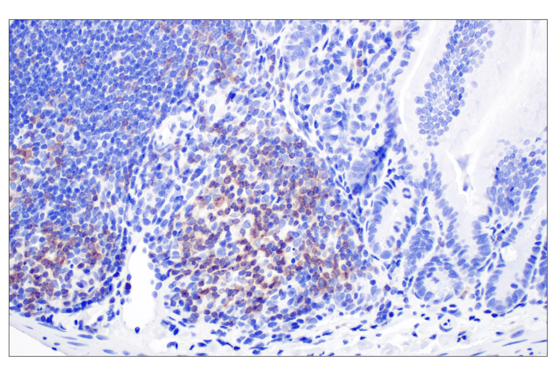 Immunohistochemistry Image 4: CD27 (F3R2V) Rabbit mAb