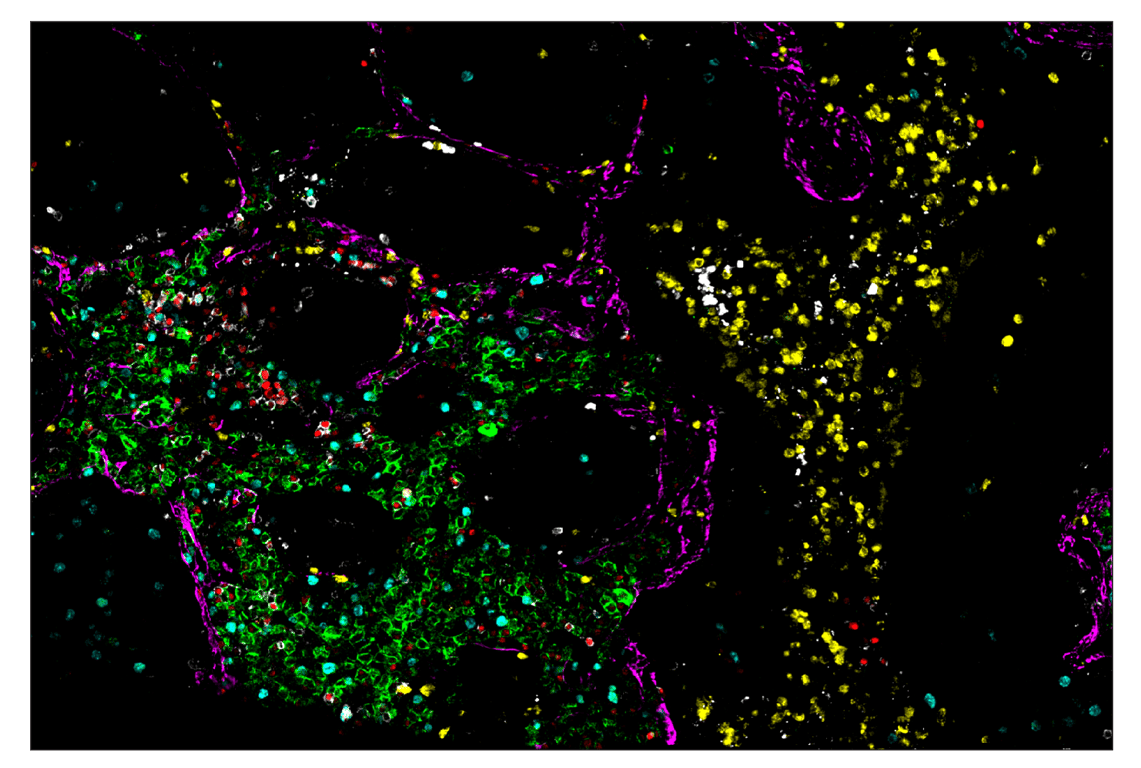 Immunohistochemistry Image 1: CD19 (Intracellular Domain) (D4V4B) & CO-0054-594 SignalStar<sup>™</sup> Oligo-Antibody Pair