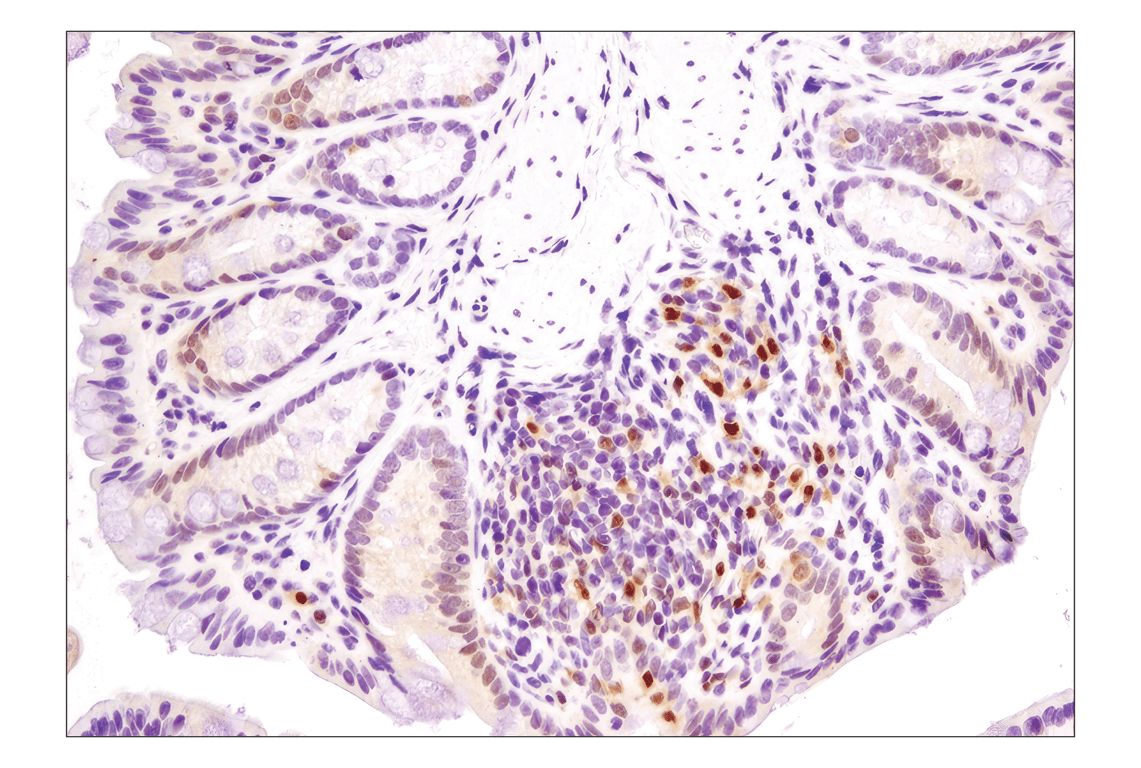 undefined Image 5: PhosphoPlus<sup>®</sup> p38 MAPK (Thr180/Tyr182) Antibody Duet