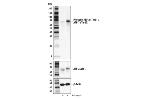 Western Blotting Image 1: Phospho-ATF-2 (Thr71)/ATF-7 (Thr53) (A8J7P) Rabbit mAb