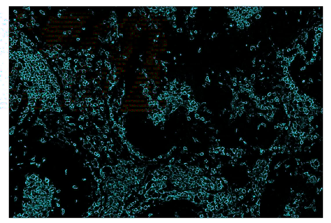 Immunohistochemistry Image 5: CD45 (Intracellular Domain) (D9M8I) & CO-0013-647 SignalStar<sup>™</sup> Oligo-Antibody Pair