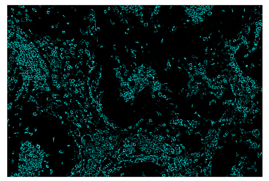 Immunohistochemistry Image 5: CD45 (Intracellular Domain) (D9M8I) & CO-0013-647 SignalStar<sup>™</sup> Oligo-Antibody Pair