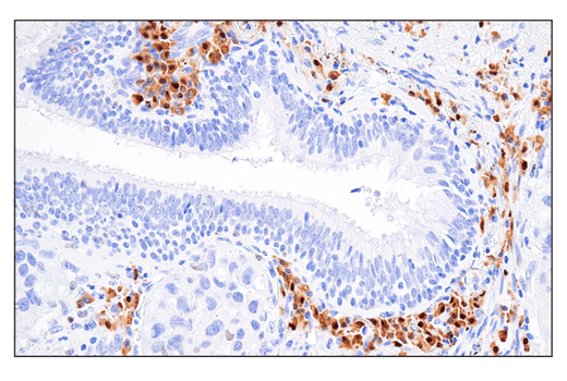 Immunohistochemistry Image 7: IRF-4 (E8H3S) XP<sup>®</sup> Rabbit mAb (BSA and Azide Free)