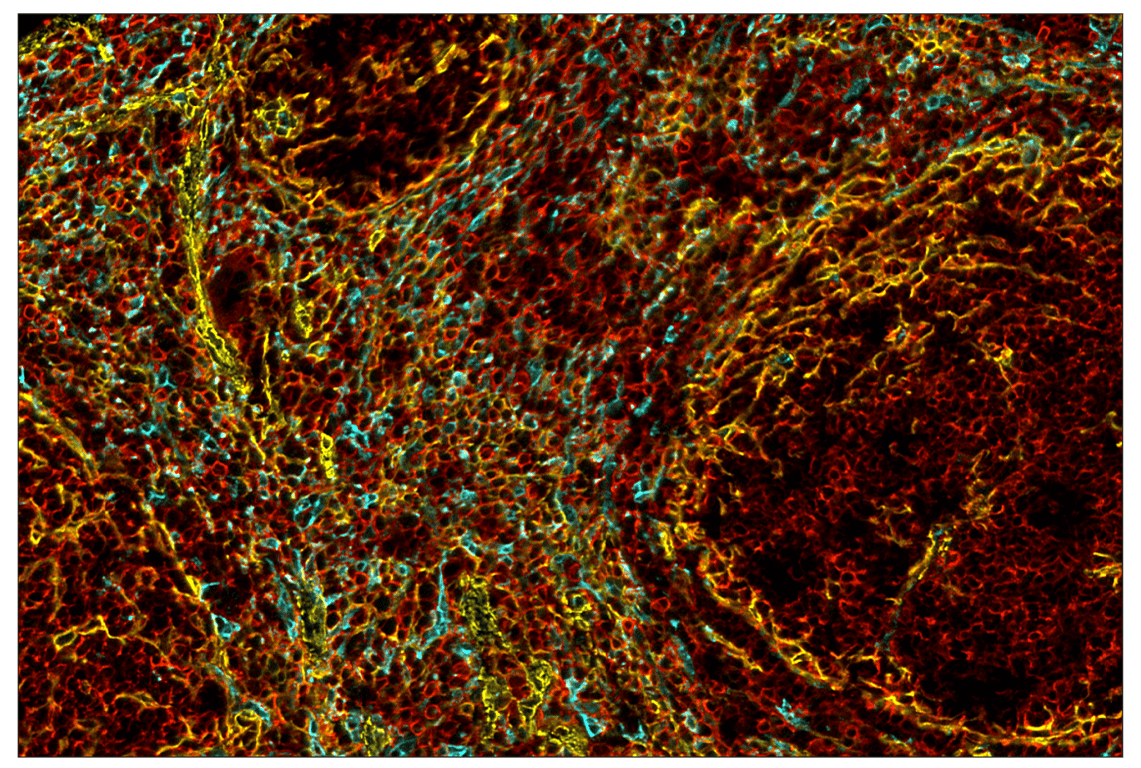 Immunohistochemistry Image 2: CD206/MRC1 (E6T5J) & CO-0032-647 SignalStar<sup>™</sup> Oligo-Antibody Pair