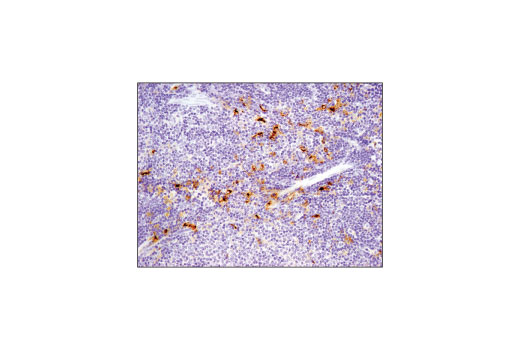 Immunohistochemistry Image 2: TIM-3 (D3M9R) XP<sup>®</sup> Rabbit mAb