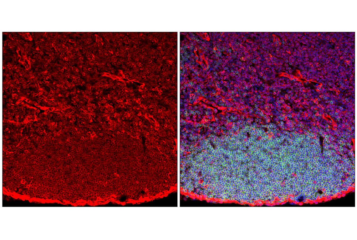 Immunofluorescence Image 2: STING (E9X7F) Rabbit mAb