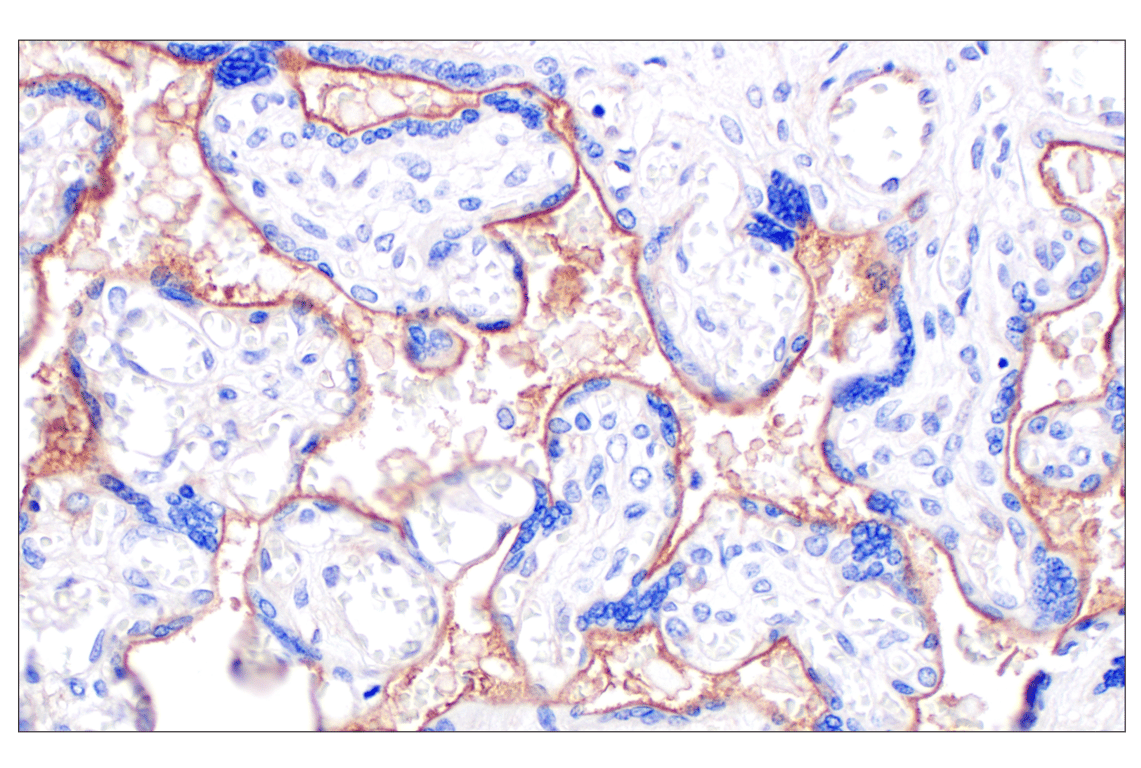 Immunohistochemistry Image 4: CD105/Endoglin (F9C5Q) Rabbit mAb
