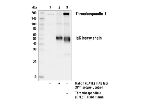 undefined Image 20: Extracellular Matrix Dynamics Antibody Sampler Kit