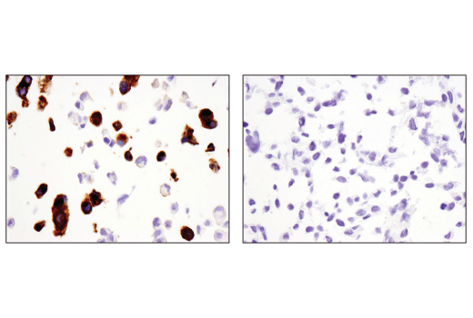 Immunohistochemistry Image 1: Synaptophysin (D8F6H) XP<sup>®</sup> Rabbit mAb (BSA and Azide Free)